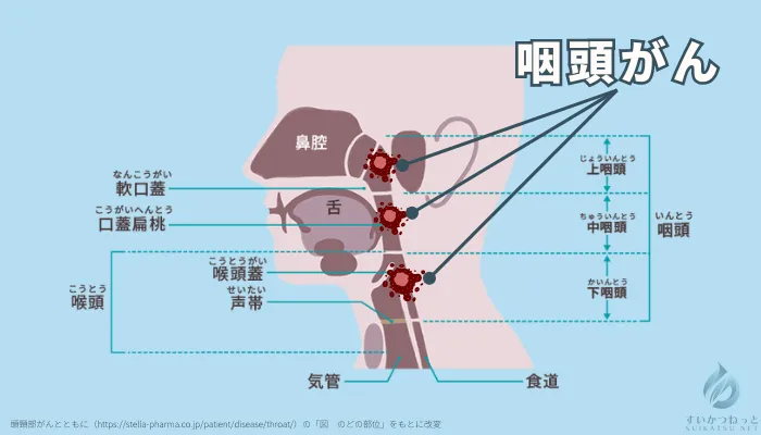 咽頭がんとはどんな病気?ー水素健康活用研究所のインフォグラフィックシリーズ
