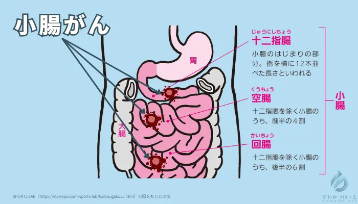 小腸がんとはどんな病気?