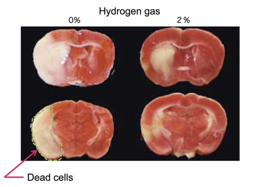 脳虚血モデルラットの脳切片。水素0%群(左)は白い壊死領域が広く、水素2%群(右)では大幅に縮小している。(Ohta, 2012, Fig.5より引用)