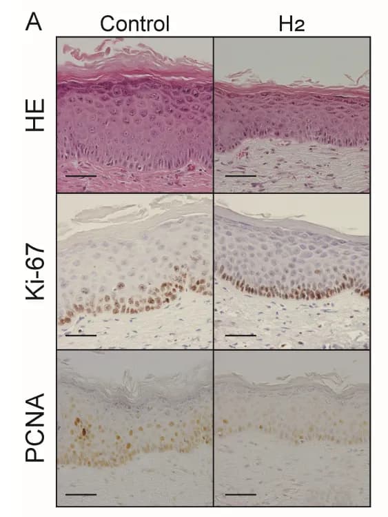 UVB照射後の皮膚断面。水素群では表皮の肥厚が抑えられている(Hori et al., 2026, Fig.7Aより引用)