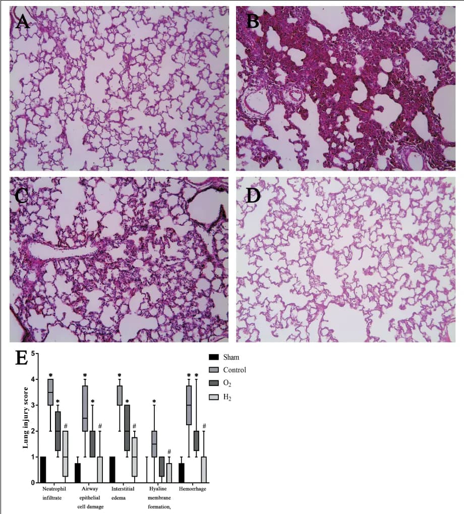 各群の肺組織の顕微鏡像と肺傷害スコア(Zheng et al., 2021, Fig.5より引用)